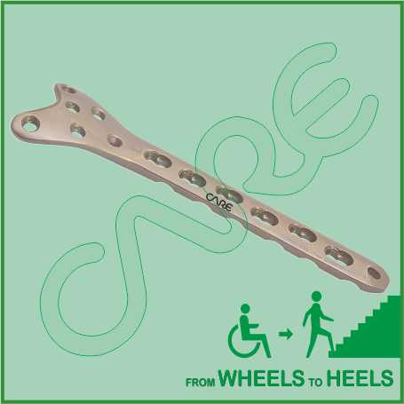 Locking Plate Condylar Butteress 4.5/5.0mm, Right/Left