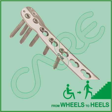 Locking Plate Anatomical Distal Tibia 4.5/5.0mm, Right/Left